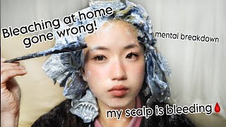 BLEACHING MY HAIR AT HOME WENT HORRIBLY WRONGbleach burnblood scabs and healing [upl. by Aserehtairam488]