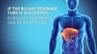 Biliary Drain [upl. by Ehsiom]