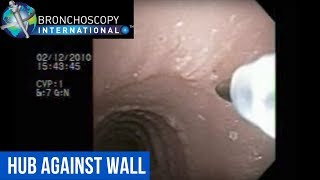 Flexible Bronchoscopy Basic Techniques 7 TBNA Hub Against Wall [upl. by Isador]