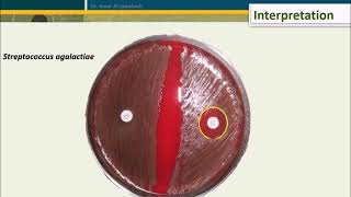 Bacitracin test for Streptococcus pyogenes [upl. by Marys]