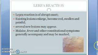 Pharmacology 770 c Anti Leprosy MultiDrug Therapy Lepra Reaction Paucibacillary Multibacillary MDT [upl. by Aelahc]