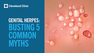 Busting 5 Myths About Genital Herpes [upl. by Idnal]