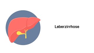 Leberzirrhose  Erkrankungen von Leber Gallenwege und Pankreas [upl. by Indys]