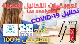 ✅ CNOPS CNSS تعويضات التحاليل الطبية [upl. by Meluhs]