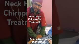 Neck Hump Chiropractic Treatment by Dr Atin Banerjee [upl. by Eniamrej325]