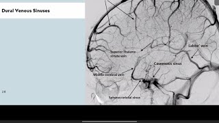 MASTERING ANGIOGRAMS FOR FRCR 1PART 4 [upl. by Arst]