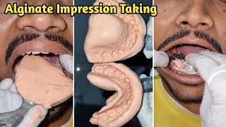 Alginate Impression Taking  Dental Impression  Alginate Impression [upl. by Attenol]