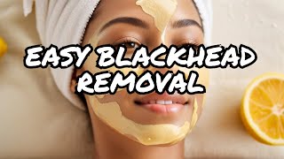 Unlock the Power of Natural Remedies Say Goodbye to Blackheads at Home [upl. by Eckblad]