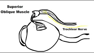 Cranial Nerve 4 Palsy [upl. by Colpin]