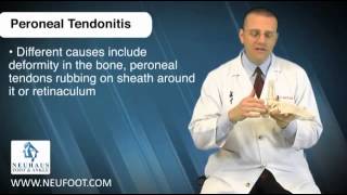 Peroneal Tendinitis is a Common Running Injury [upl. by Akkinahs]