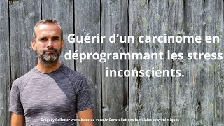 Guérir dun carcinome  cancer dans une narine  afin déviter lablation du nez cest possible [upl. by Eladnar]