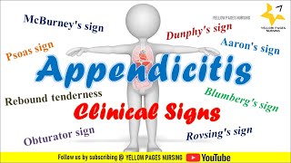 Clinical signs of Appendicitis  NCLEX REVIEW [upl. by Gney77]