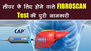 fibroscan liver  fibroscan  test price score results  in hindi  fibroscan test kaise hota hai [upl. by Lander]