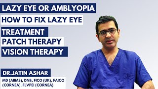 Amblyopia Lazy Eye  Meaning  Treatment of Amblyopia Lazy Eye  Patch amp Vision Therapy Exercise [upl. by Assilak]