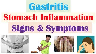 Gastritis Stomach Inflammation Signs amp Symptoms Complications amp Why They Occur [upl. by Seumas]