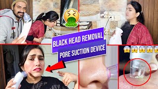 Review Do blackhead remover vacuums work and are they a good idea [upl. by Pasquale507]