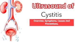 Treatment of Cystitis  Ultrasound of bladder cystitis  Medicine information  Medical knowledge [upl. by Annavaj]