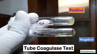 Tube Coagulase Test Positive and Negative Demonstration [upl. by Giuseppe]