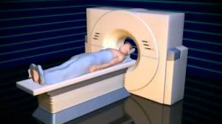 What Is a CAT Scan [upl. by Scheld]