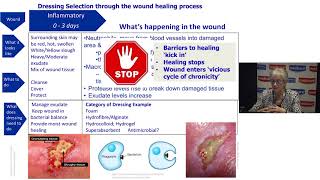 Understanding Wound Dressings Categories and Indications [upl. by Annawot295]