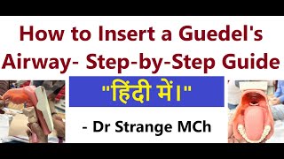 How to Insert a Guedels Airway हिंदी में।   A StepbyStep Guide GuedelsAirway CPR [upl. by Ailat]