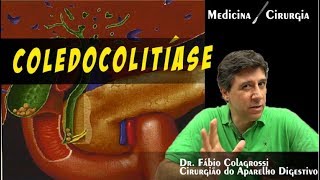 COLEDOCOLITÍASE [upl. by Gavrah]