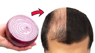 Haare wachsen wie verrückt und fallen nicht aus Stimuliert das Haarwachstum Omas Rezept💯 [upl. by Akehsal]