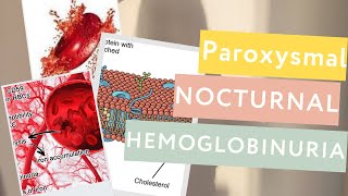 Paroxysmal Nocturnal Hemoglobinuria PNHDefinitionPathophysiologyTreatment [upl. by Nart]