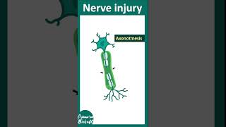 Types of nerve injury  neuropraxia  axonotmesis  neurotmesis  Wallerian degeneration  USMLE [upl. by Farkas472]