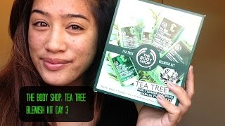 The Body Shop Tea Tree Blemish Kit Day 3 [upl. by Conley]