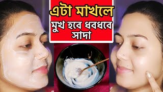 এটা মাখলে  ঘরে বসেই মুখ হবে ধবধবে সাদাmukhar Kalo dag dur korar upaiskin whitening packDtan pack [upl. by Borlase451]