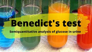 Bence Jones Protein  Procedure and Principle [upl. by Ylrebmic]