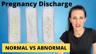 Pregnancy Discharge  Vaginal Discharge During Pregnancy  WHAT TO KNOW [upl. by Elianore597]