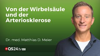 Die Ursachen Entstehung und Heilung von Arteriosklerose  Naturmedizin  QS24 [upl. by Aiuqcaj]