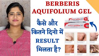 Berberis Aquifolium Gel for Acne and Scars ॥ कैसे और कितने दिनो में Result मिलता है [upl. by Atelra]