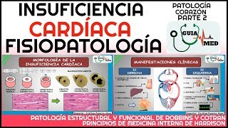 INSUFICIENCIA CARDÍACA FISIOPATOLOGÍA  GuiaMed [upl. by Danella]