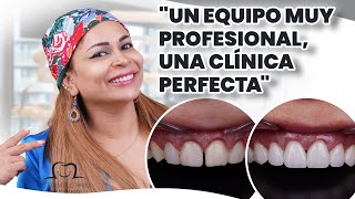 ¡Una Transformación de Sonrisa Increíble en Dental Estambul [upl. by Notsnarc]