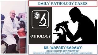 DAILY PATHOLOGY CASES CASE NO 3 BY DR WAFAEY BADAWY [upl. by Josephson]