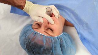 NuMask in Anesthesiology IntraOral Mask IOM®  Oropharyngeal Airway OPA Training Video [upl. by Dannel]