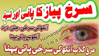 Eye infection redness চোখের সংক্রমণ आंखों में संक्रमण Homeopathic tib a unani medicine [upl. by Schulman]