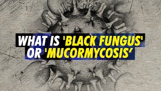 Black Fungus or Mucormycosis Deadly fungal infection making some COVID19 patients blind in India [upl. by Ednutey430]