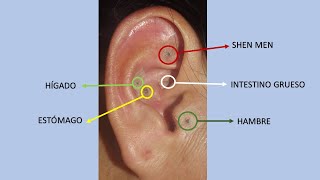 Auriculoterapia para Bajar de Peso ¿Cómo funciona Dr Ricardo Vargas H [upl. by Annaitsirk860]