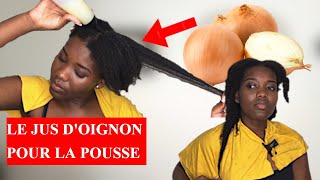 LE JUS DOIGNON POUR LA POUSSE DES CHEVEUX  TEST amp AVIS [upl. by Anatol]