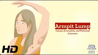 Unveiling the Mystery Understanding Armpit Lumps [upl. by Anilev]