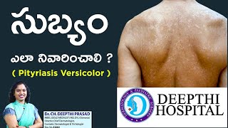 సుబ్యం ఎలా నివారించాలి  Pityriasis Versicolor  Dr Deepthi Prasad  Karimnagar [upl. by Raven]