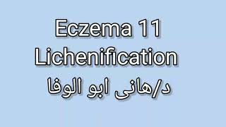 11 Lichenification by Dr Hany Abo Elwafa [upl. by Edmunda]