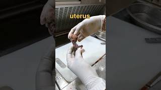 Uterus  கருப்பை  tissuefixation tissuepreparation satisfying pathology [upl. by Akiret]