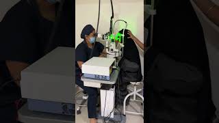 Retinal Laser Surgery Barrage laser in 2 minutes [upl. by Hurlee796]