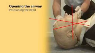 Basic Airway Management 1 [upl. by Amitie]