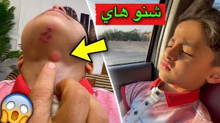 شي غربي طلع في رقبت يمان 😨 [upl. by Lanza653]